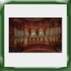 Quadranti in lega aurea e ceramica-1A